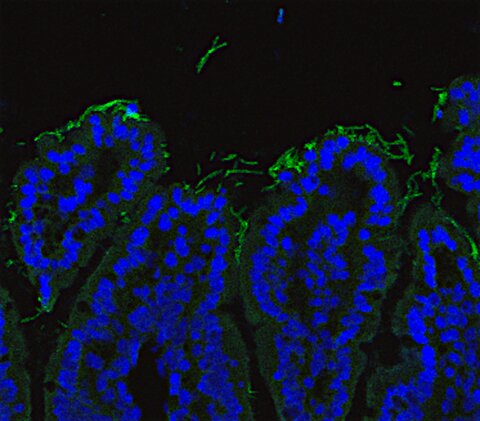 Fluorescent image of Segmented Filamentous Bacteria on the small intestinal surface.  Courtesy of Darryl Abbott